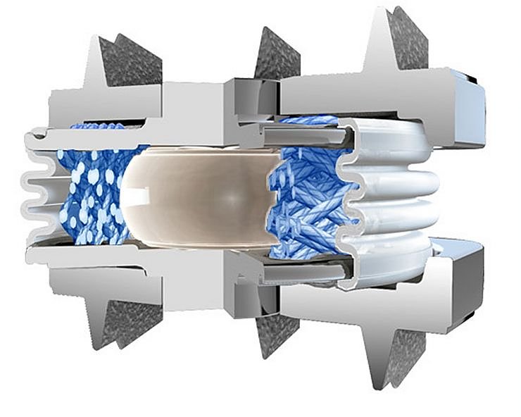 Das Bild zeigt eine k&uuml;nstliche Bandscheibenprothese der Firma &bdquo;smith & nephew&ldquo;, wie sie im S&uuml;dharz (Foto: shk)