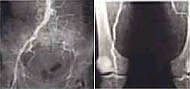 Angiographie (Foto: SHK)