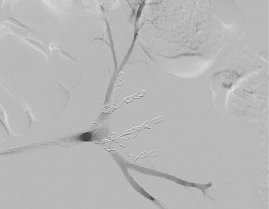 seitliche Darstellung des Vertebralisstromgebiets (Foto: SHK)