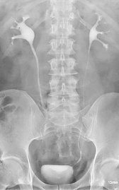 i.v. Urogramm mit Konkreten (Foto: SHK)